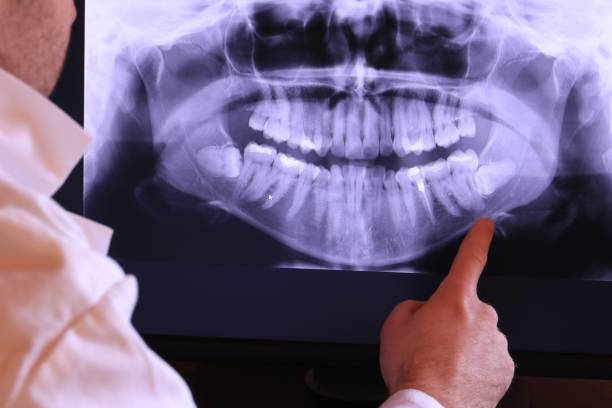 Best Emergency TMJ Treatment in Lexington, SC